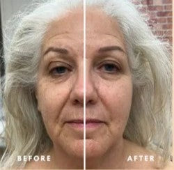 VentoShops™ Lymphatic Face Brush